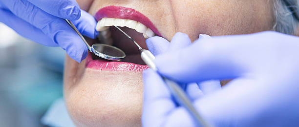 Best Emergency Dentist for Knocked-Out Tooth in Hlsboro, IL